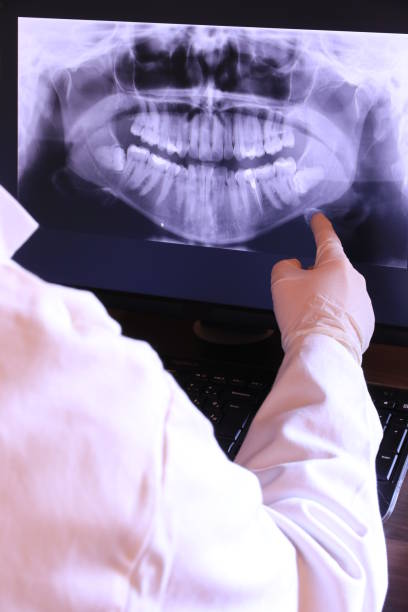 Best Emergency Treatment for Oral Infections in Wahpeton, ND