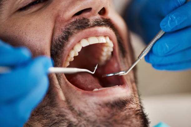 Best Walk-In Emergency Dental Services in Wahpeton, ND
